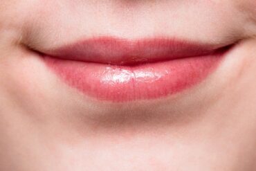 Dissolving Lip Filler: What to Expect and How It Works